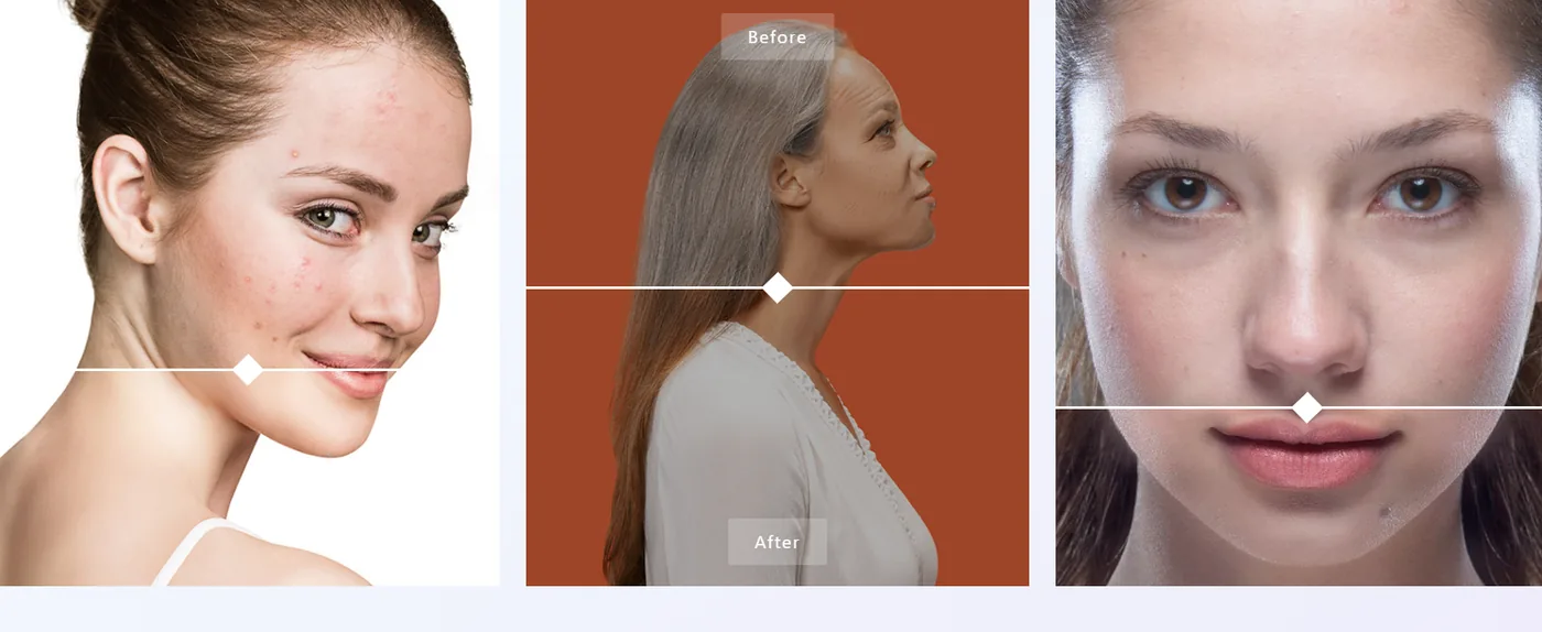 Element Pack Before/After Image Compare slider for transformation stories Element Pack Before/After Image Compare slider for transformation stories